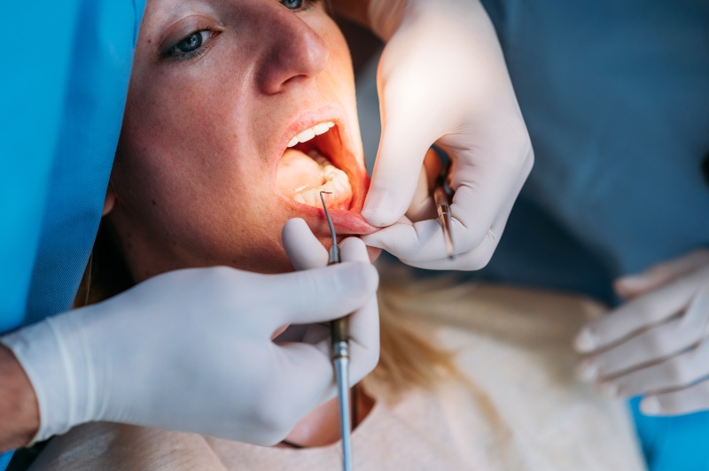Dental enamel contouring procedure performed with precision instruments in Mokena, IL